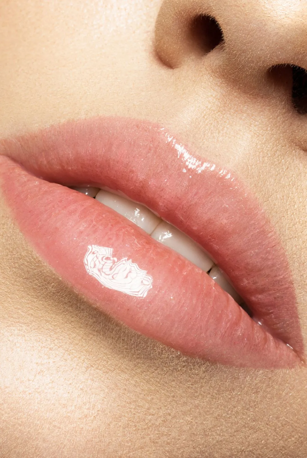 Juvederm