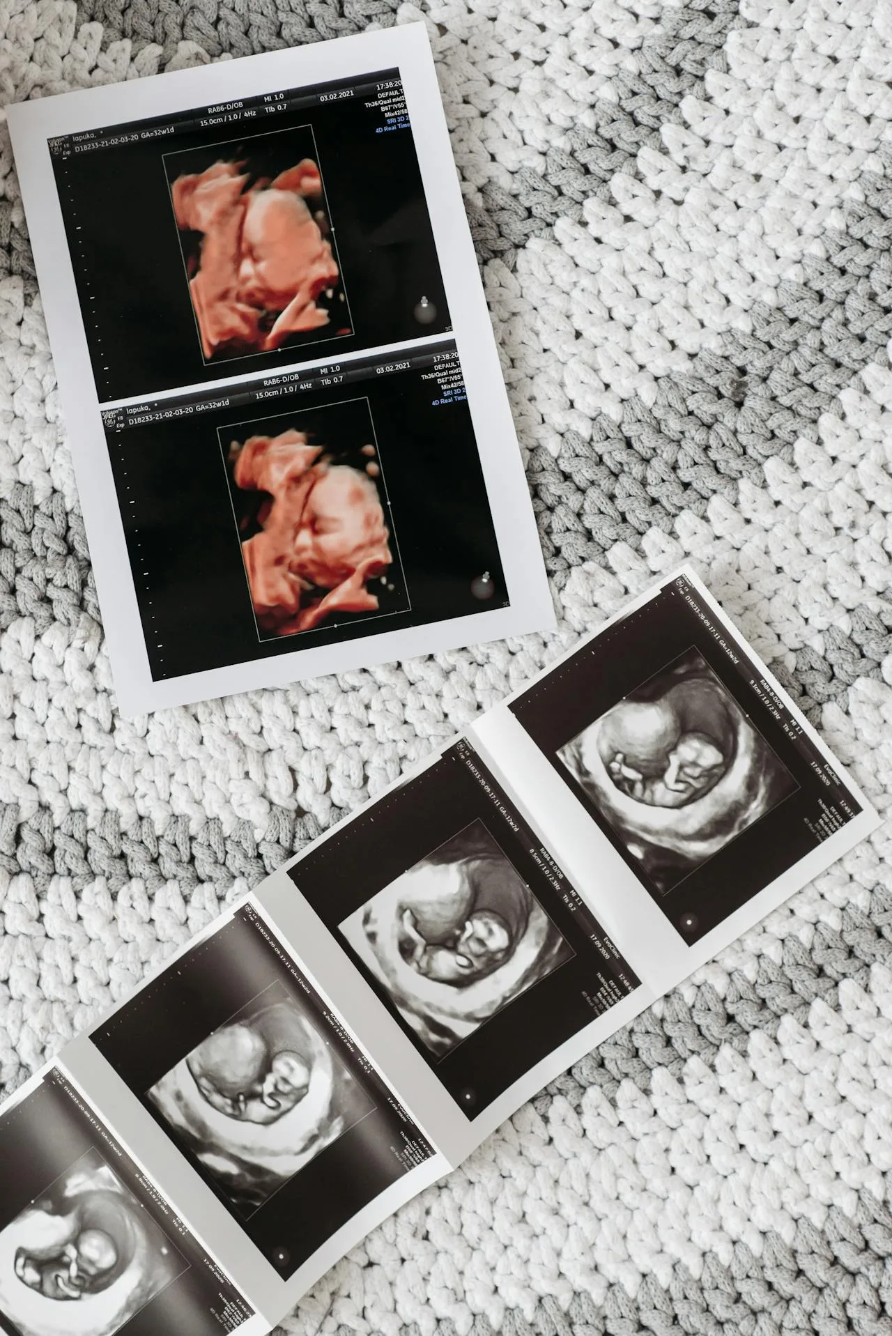 ultrasound images on patterned rug