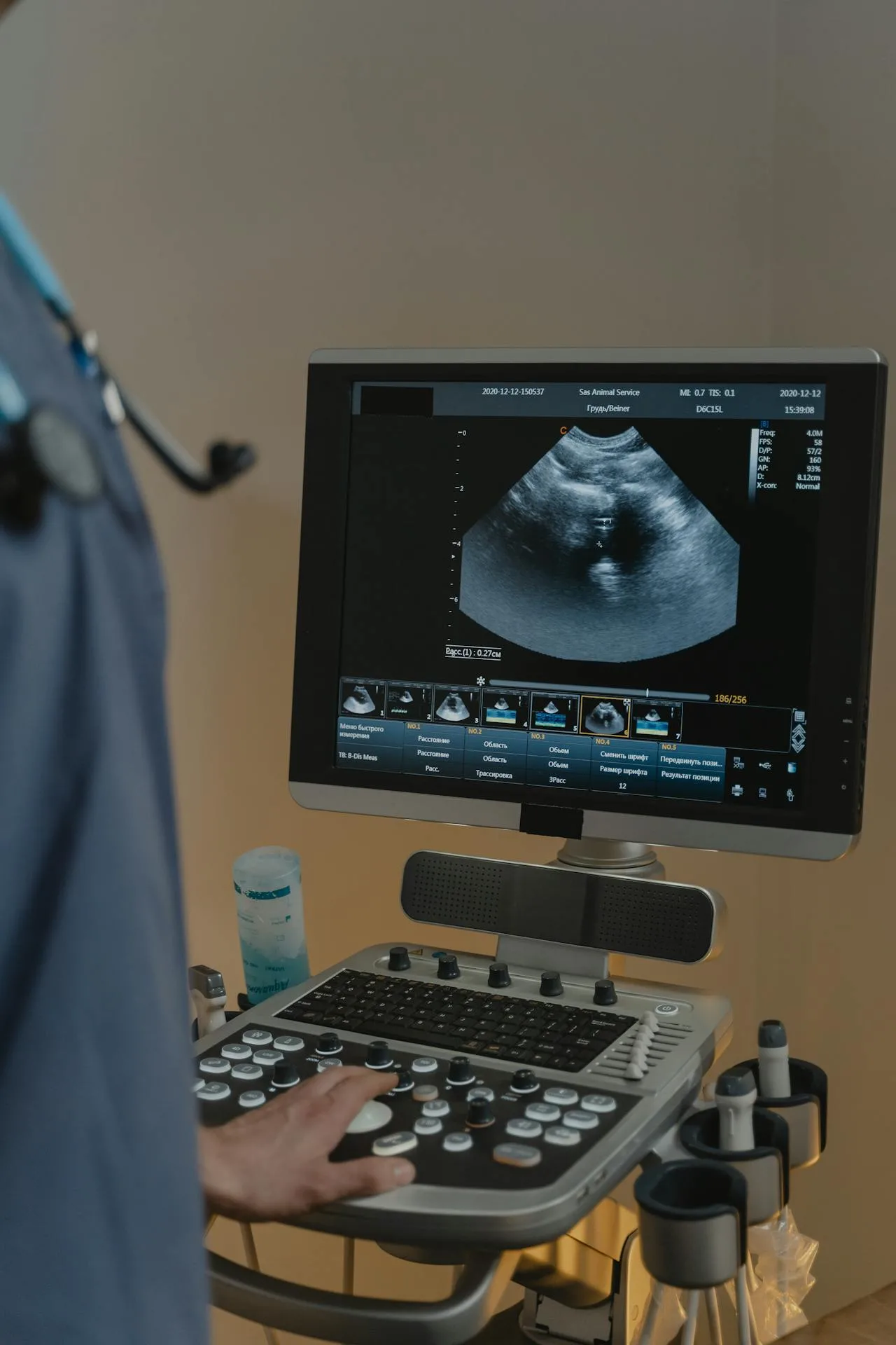 ultrasound machine in use